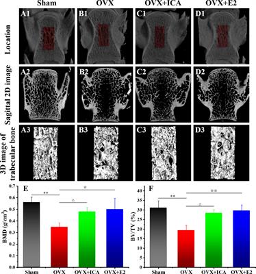 Effects of Icariin on Modulating Gut Microbiota and Regulating Metabolite Alterations to Prevent Bone Loss in Ovariectomized Rat Model